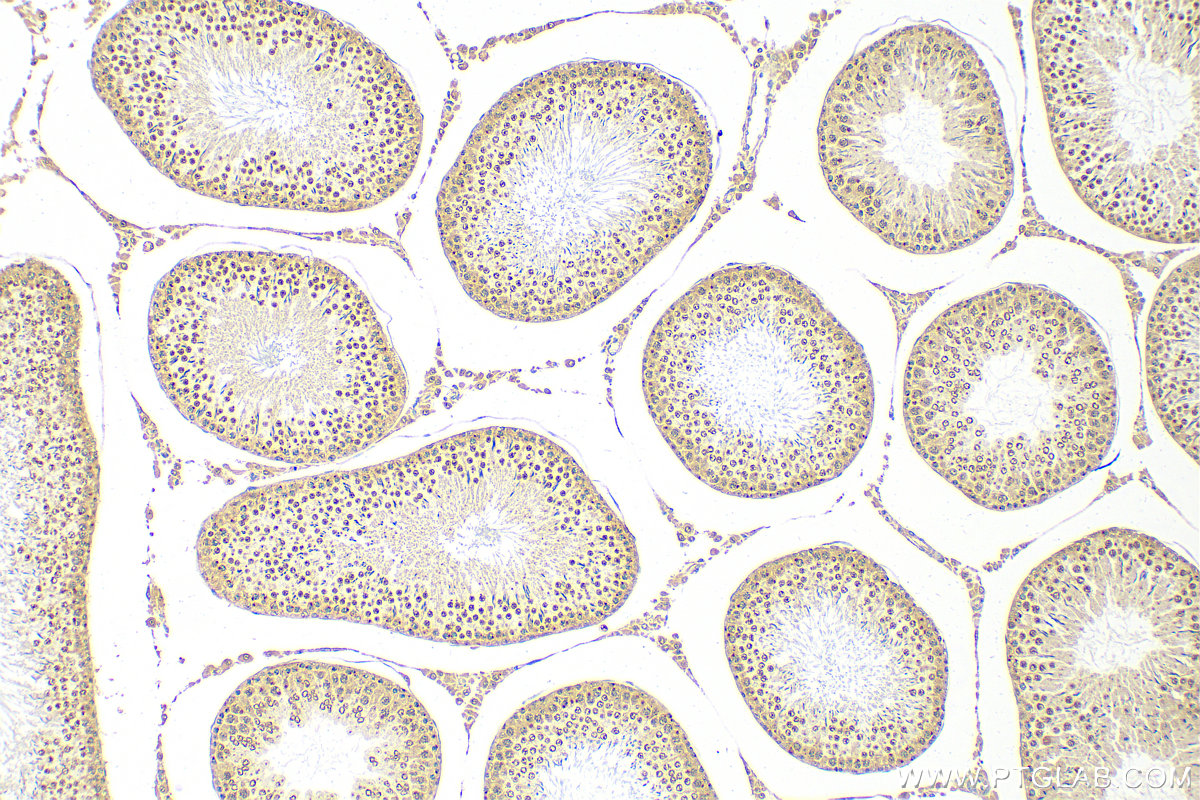 IHC staining of rat testis using 15879-1-AP