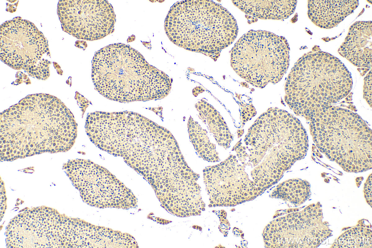 IHC staining of mouse testis using 15879-1-AP