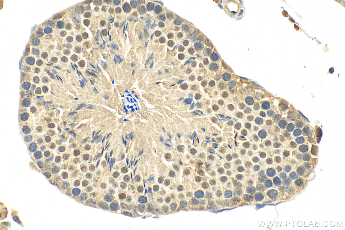 IHC staining of mouse testis using 15879-1-AP