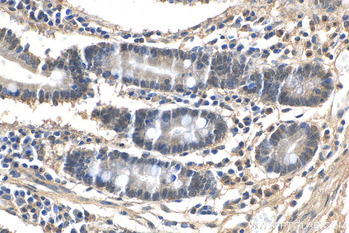 IHC staining of human stomach using 12138-1-AP