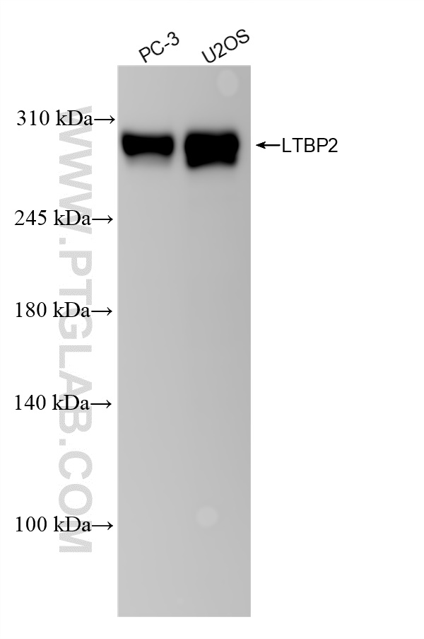 WB analysis using 84574-4-RR