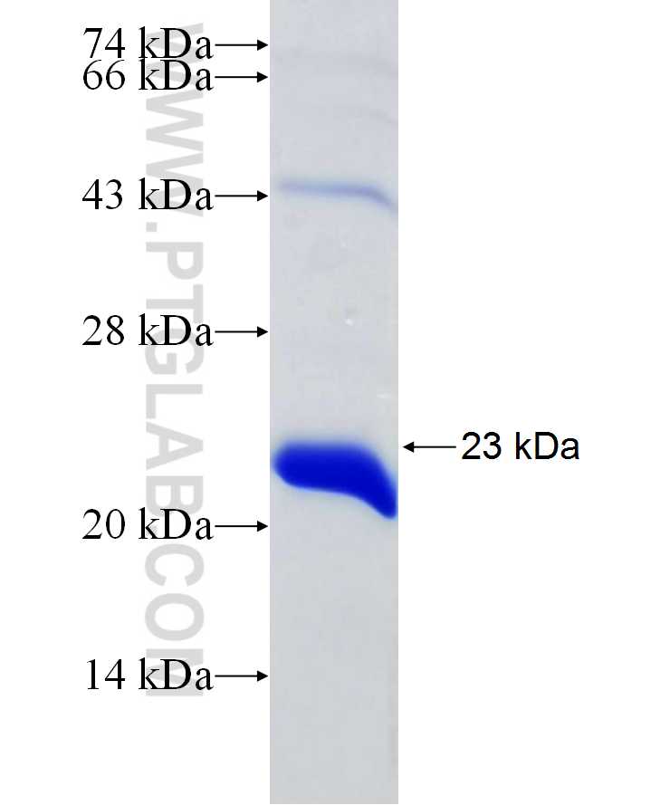 LTBP2 fusion protein Ag29737 SDS-PAGE