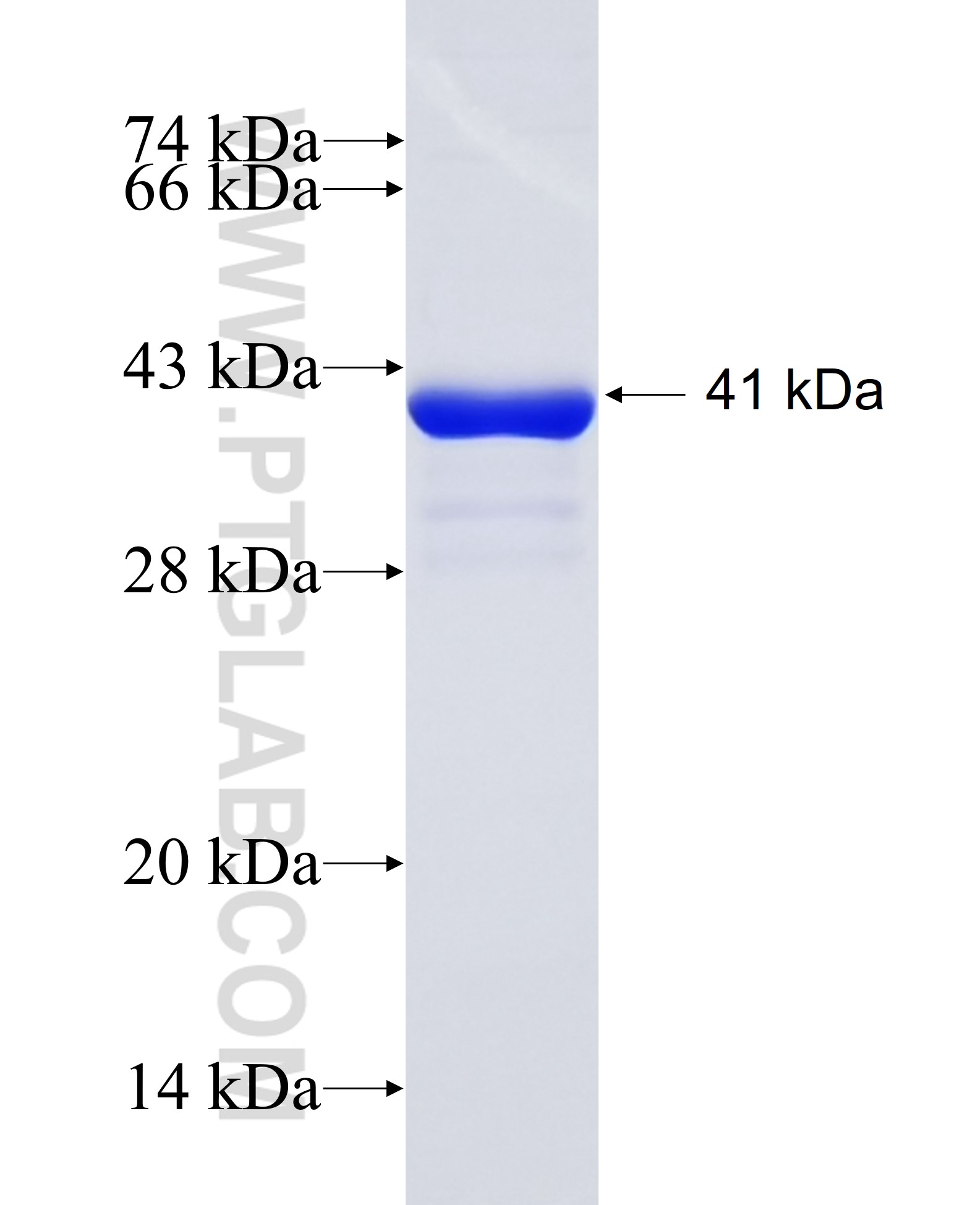 LTV1 fusion protein Ag24992 SDS-PAGE