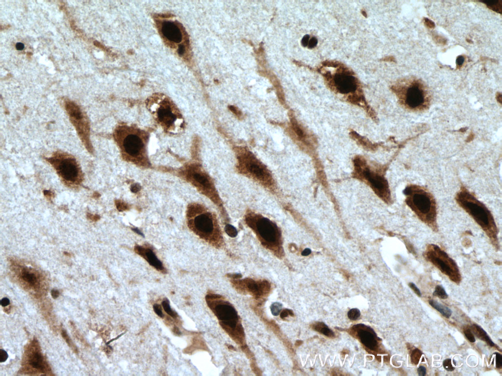 IHC staining of human brain using 17085-1-AP