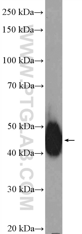 WB analysis of mouse brain using 17085-1-AP