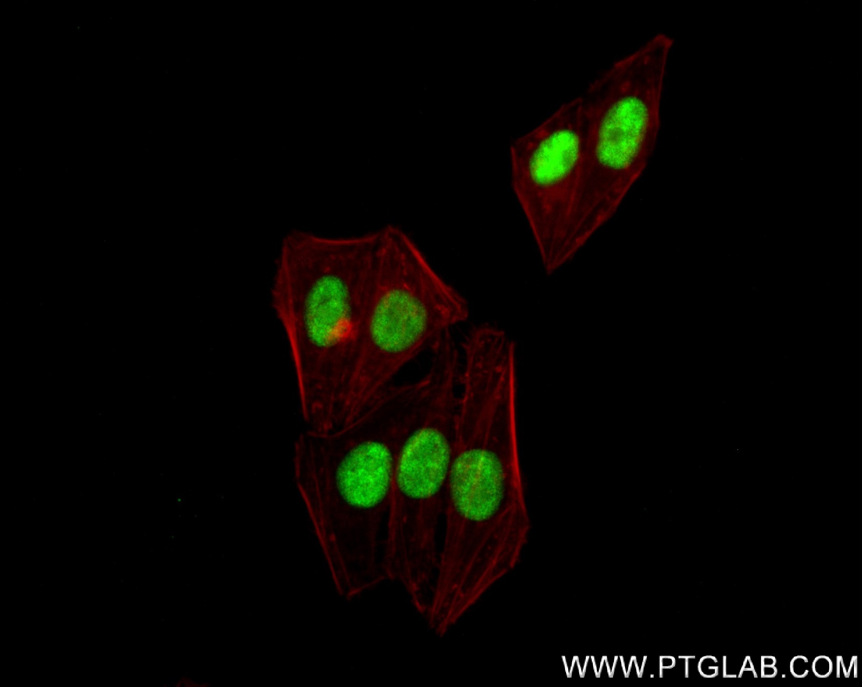 IF Staining of HepG2 using 83585-1-RR (same clone as 83585-1-PBS)