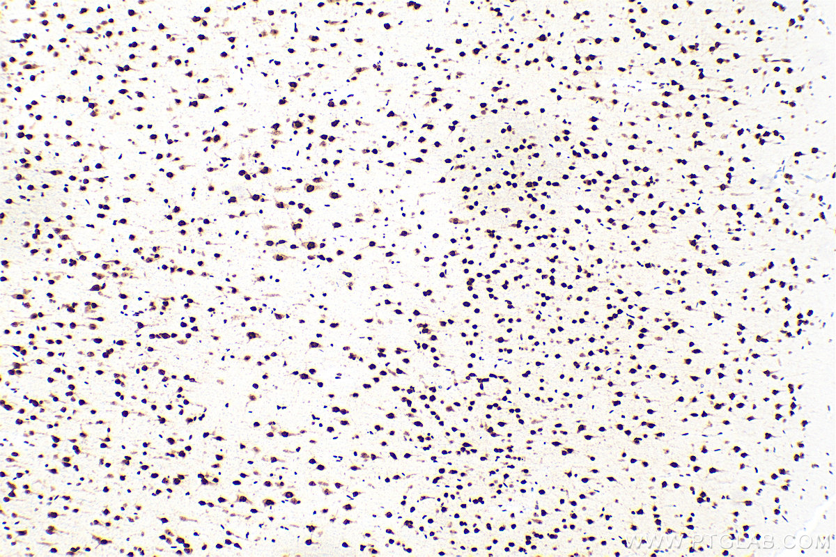 IHC staining of rat brain using 83585-1-RR (same clone as 83585-1-PBS)