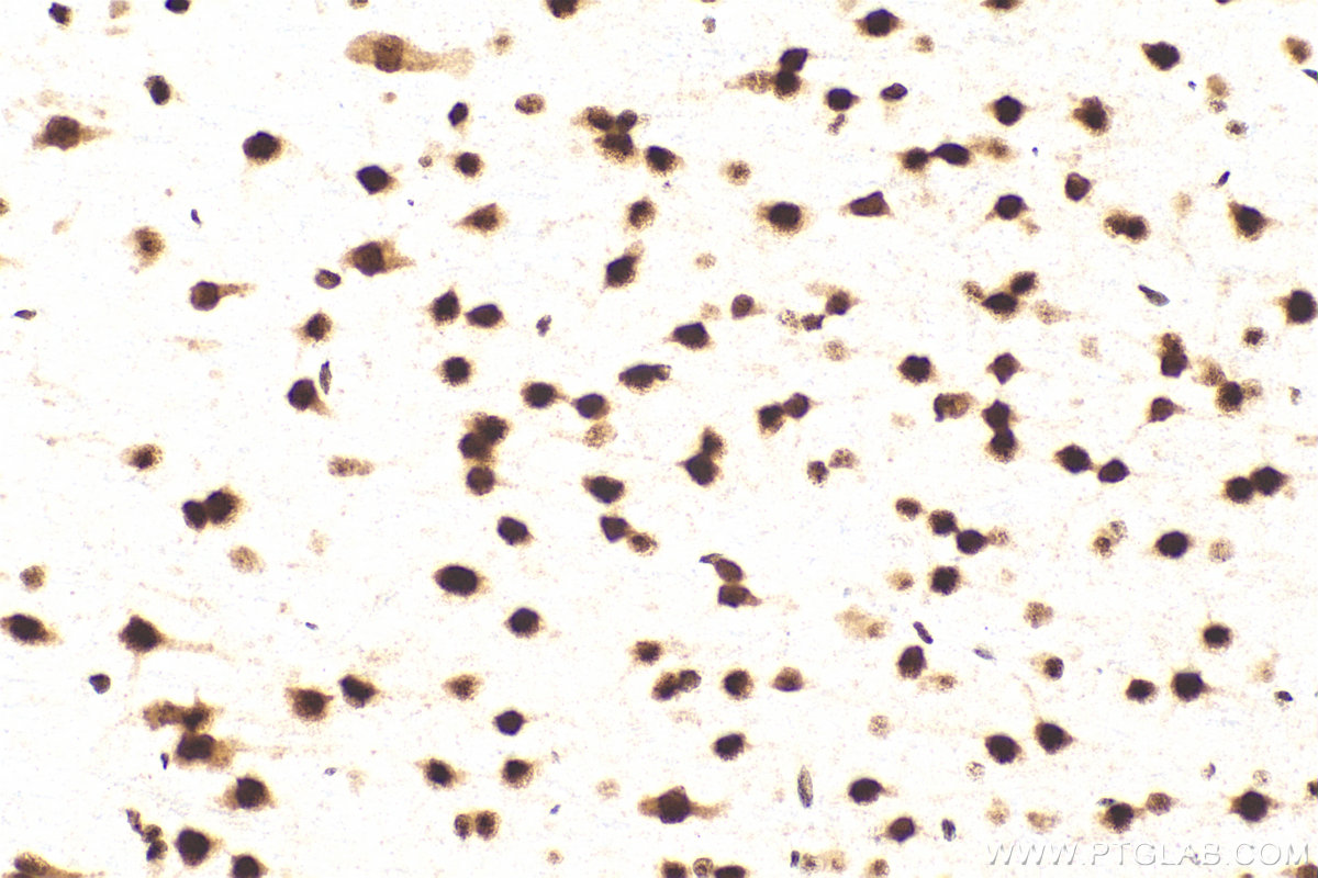 IHC staining of rat brain using 83585-1-RR (same clone as 83585-1-PBS)