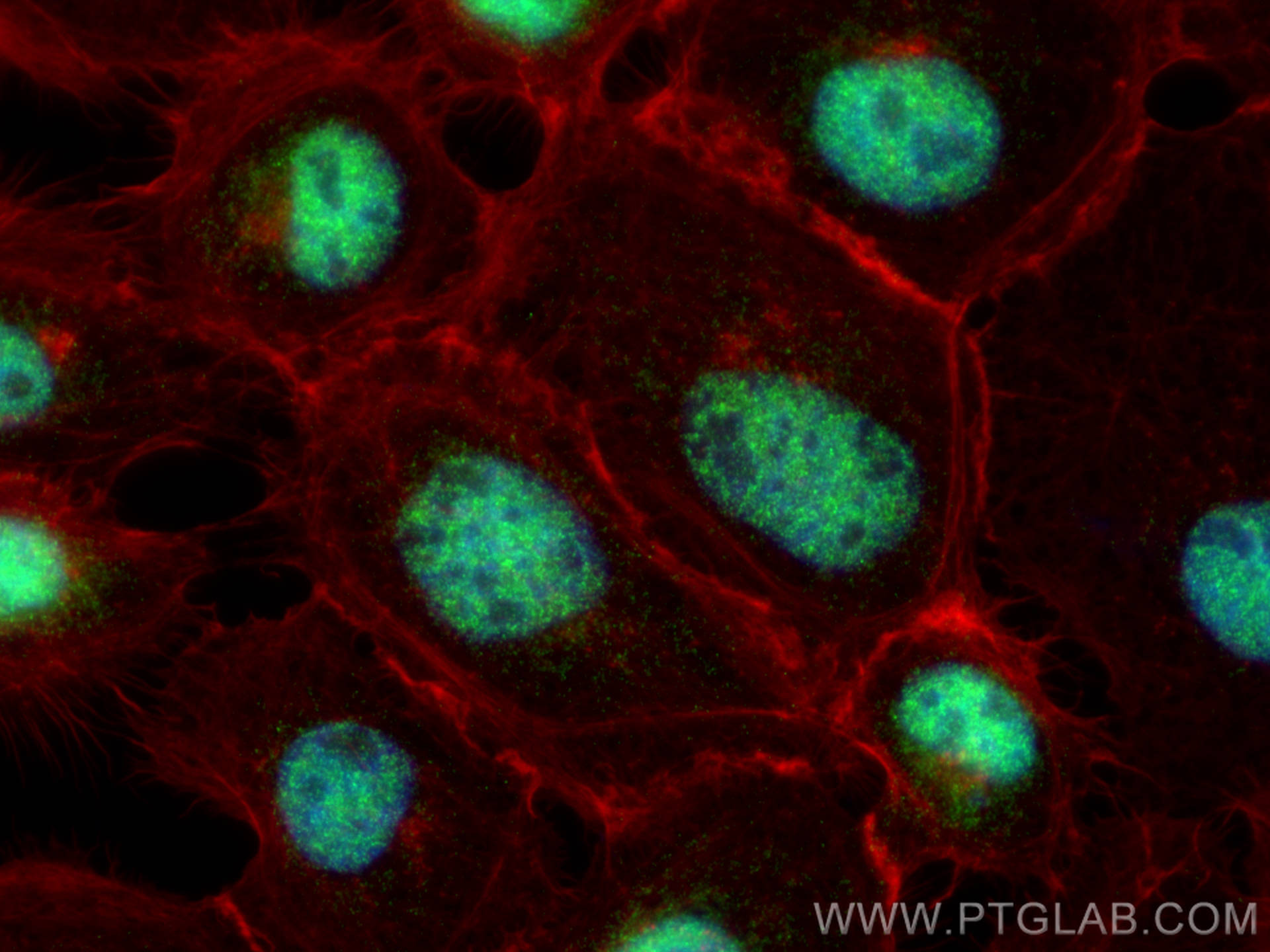 IF Staining of A431 using 24202-1-AP