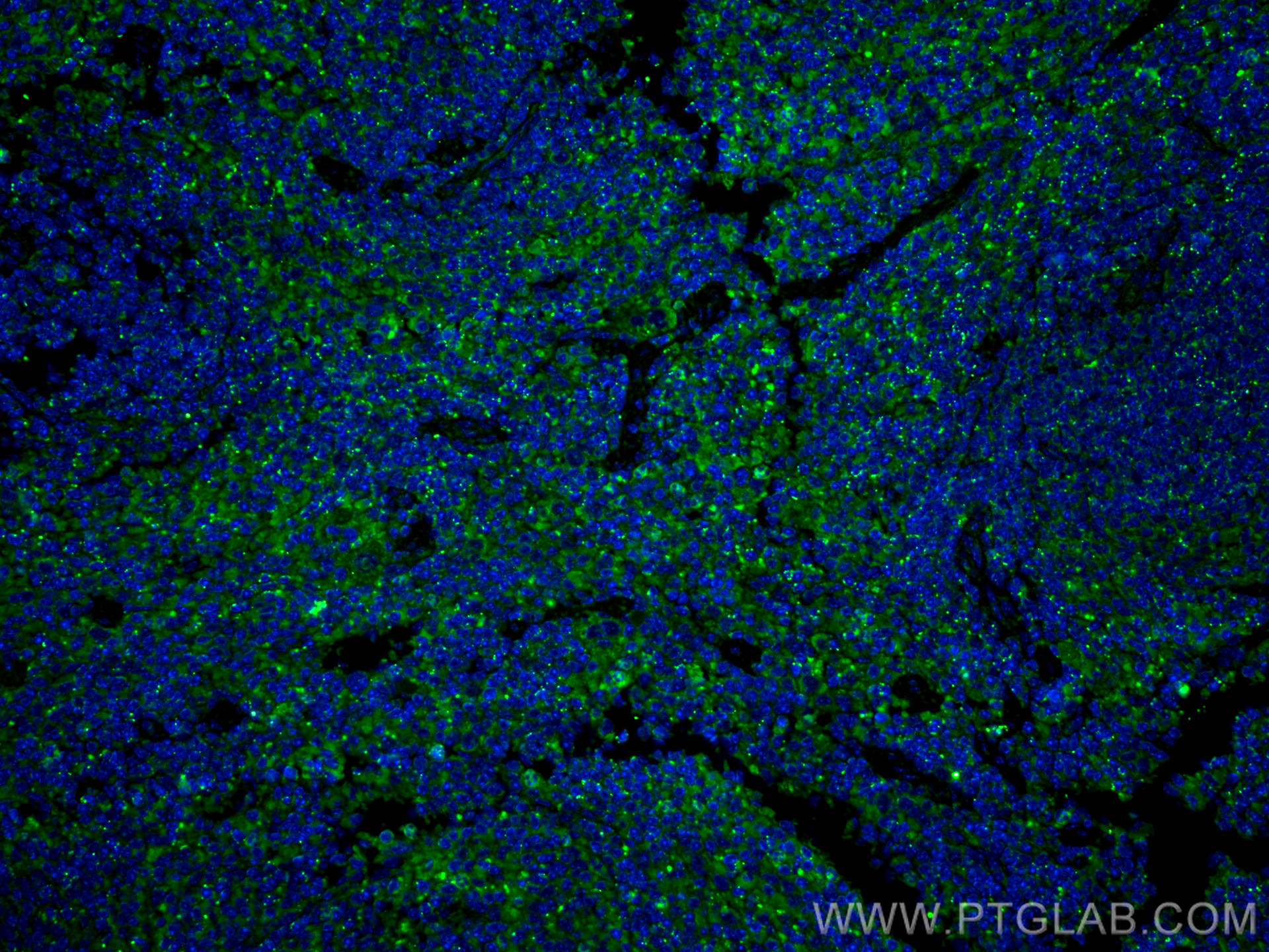 IF Staining of mouse spleen using 10677-1-AP