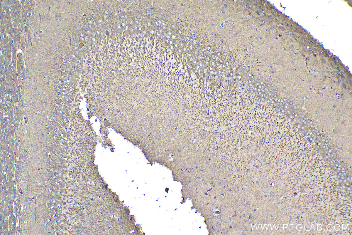 IHC staining of rat brain using 17483-1-AP