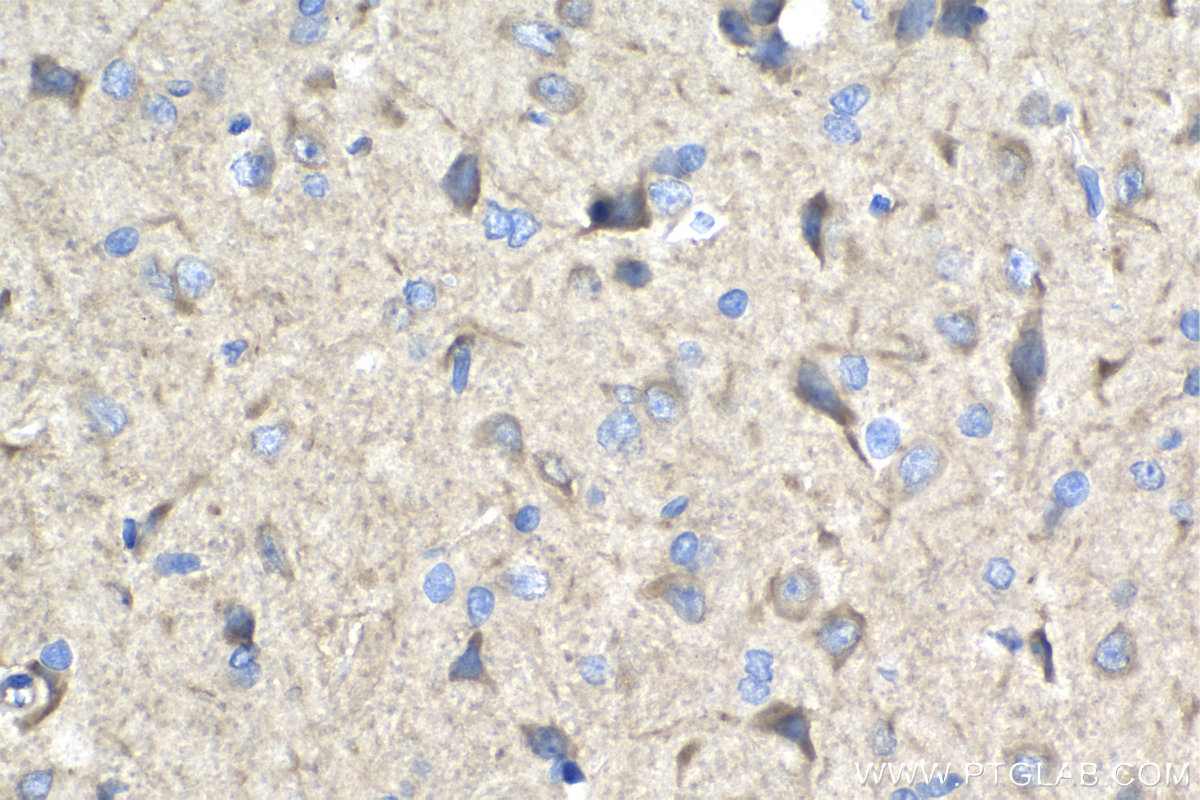 IHC staining of rat brain using 17483-1-AP