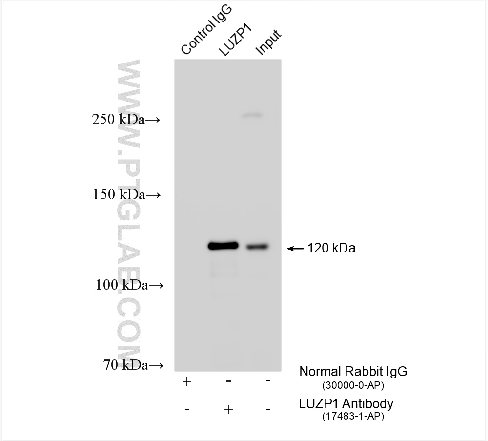 IP experiment of mouse brain using 17483-1-AP