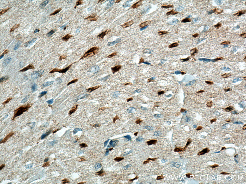 IHC staining of human heart using 66957-1-Ig (same clone as 66957-1-PBS)