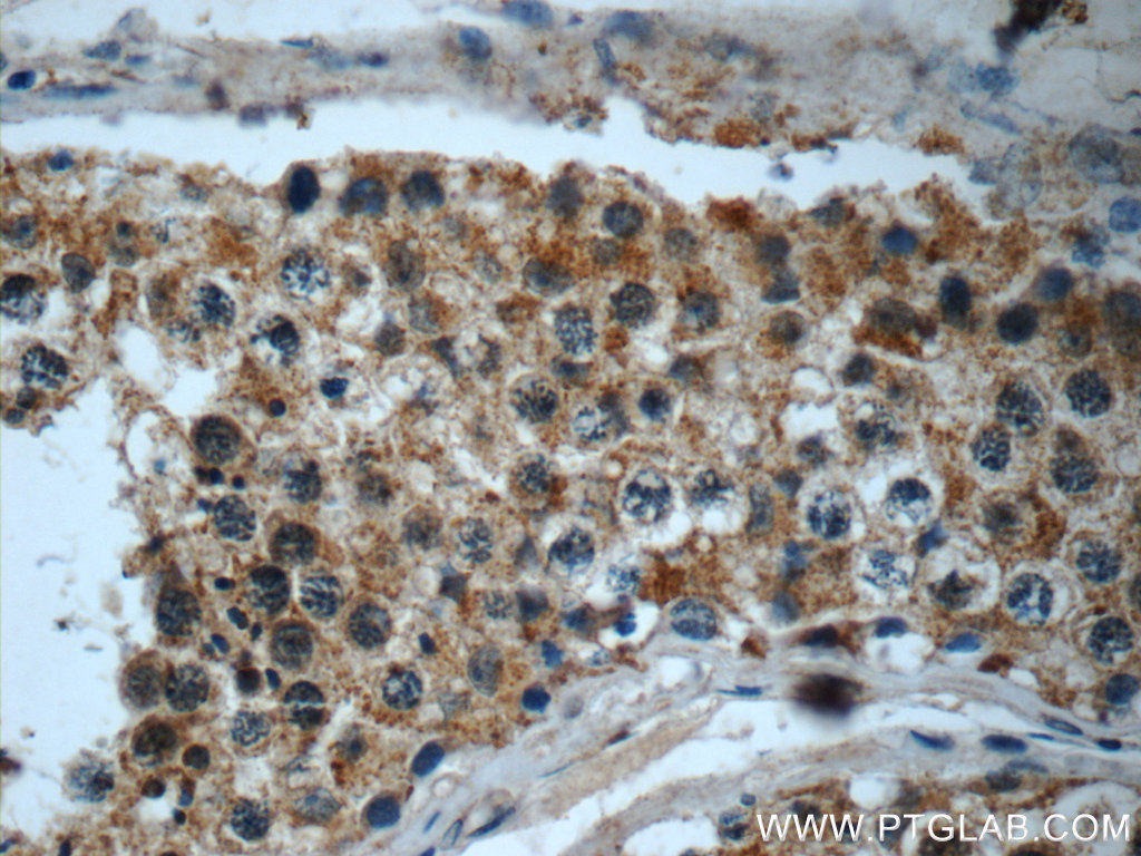 IHC staining of human testis using 23933-1-AP