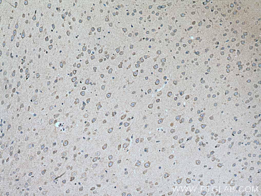 IHC staining of mouse brain using 16055-1-AP