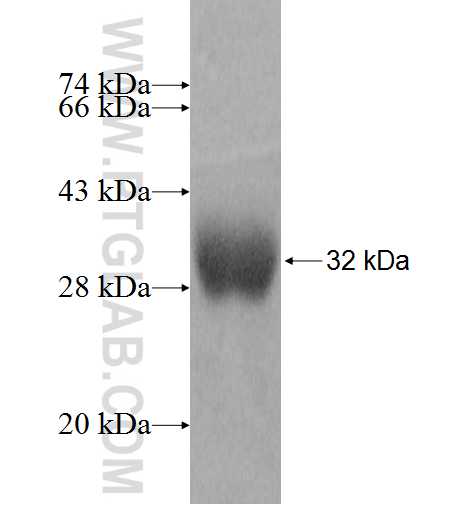 LYPLAL1 fusion protein Ag9581 SDS-PAGE