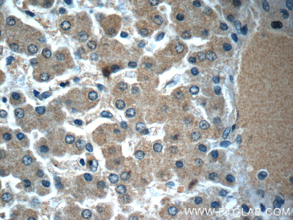 IHC staining of human liver using 23833-1-AP