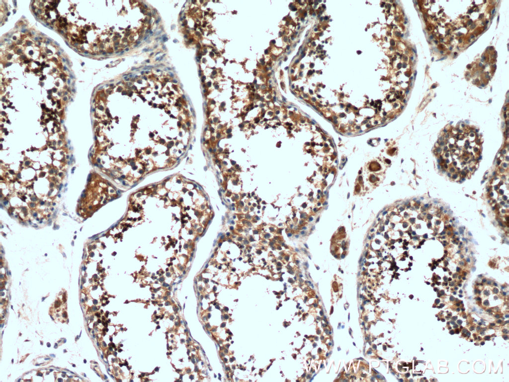 IHC staining of human testis using 17207-1-AP