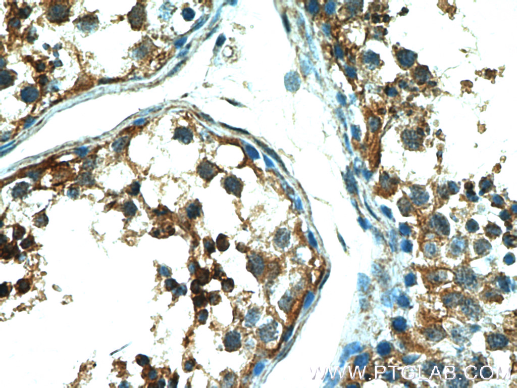 IHC staining of human testis using 17207-1-AP