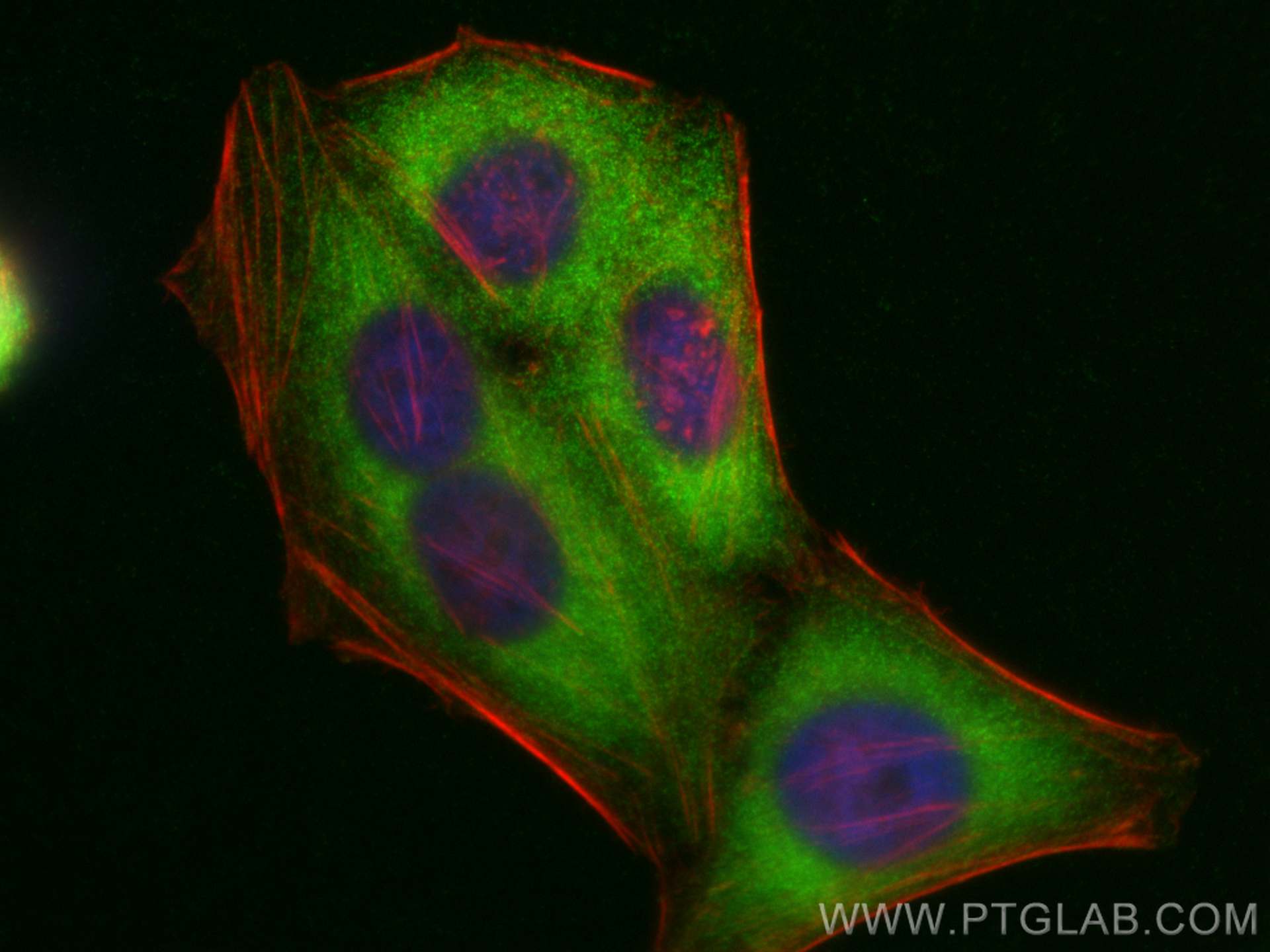 IF Staining of HepG2 using 17073-1-AP