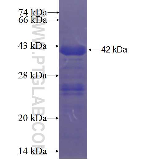 LZTR1 fusion protein Ag23399 SDS-PAGE