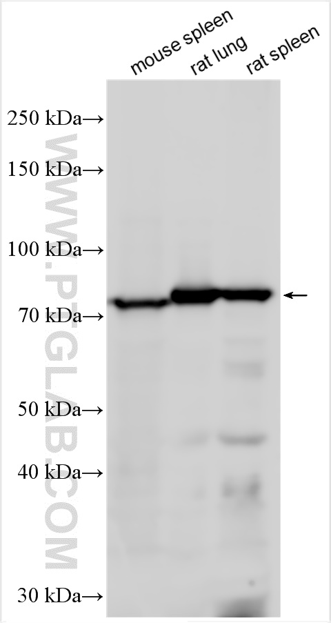 Lactotransferrin/LTF