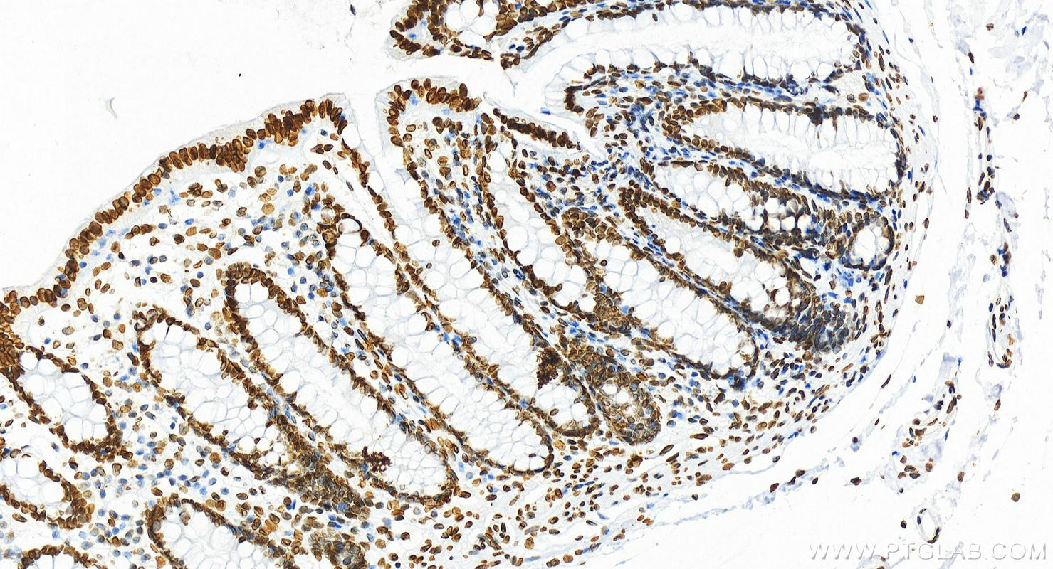 IHC staining of human colon using 81042-1-RR (same clone as 81042-1-PBS)