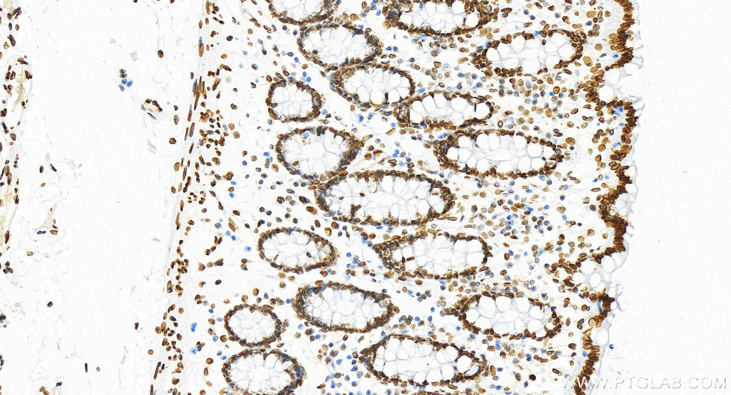 IHC staining of human colon using 81042-1-RR (same clone as 81042-1-PBS)