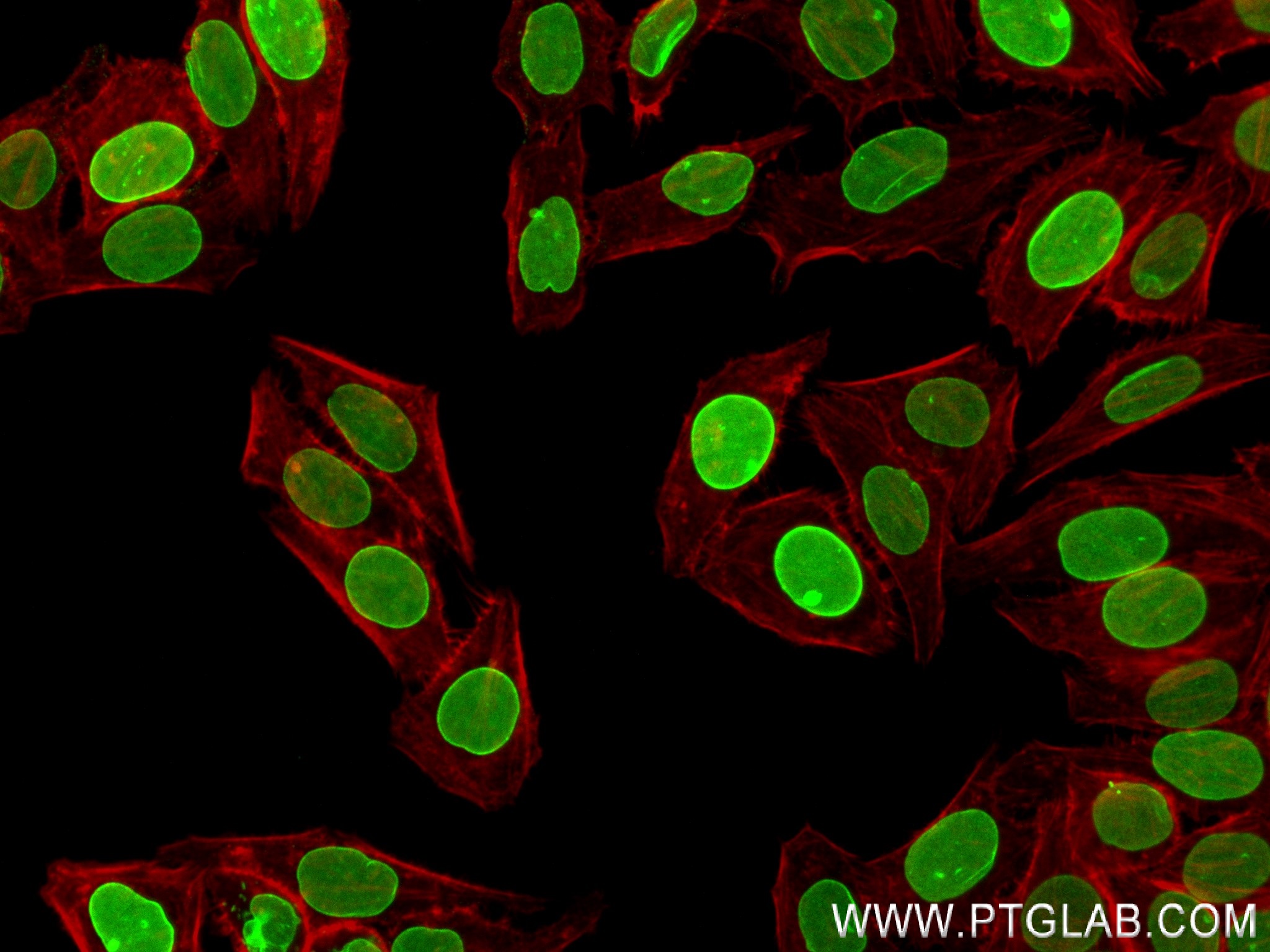 IF Staining of HepG2 using 82801-4-RR