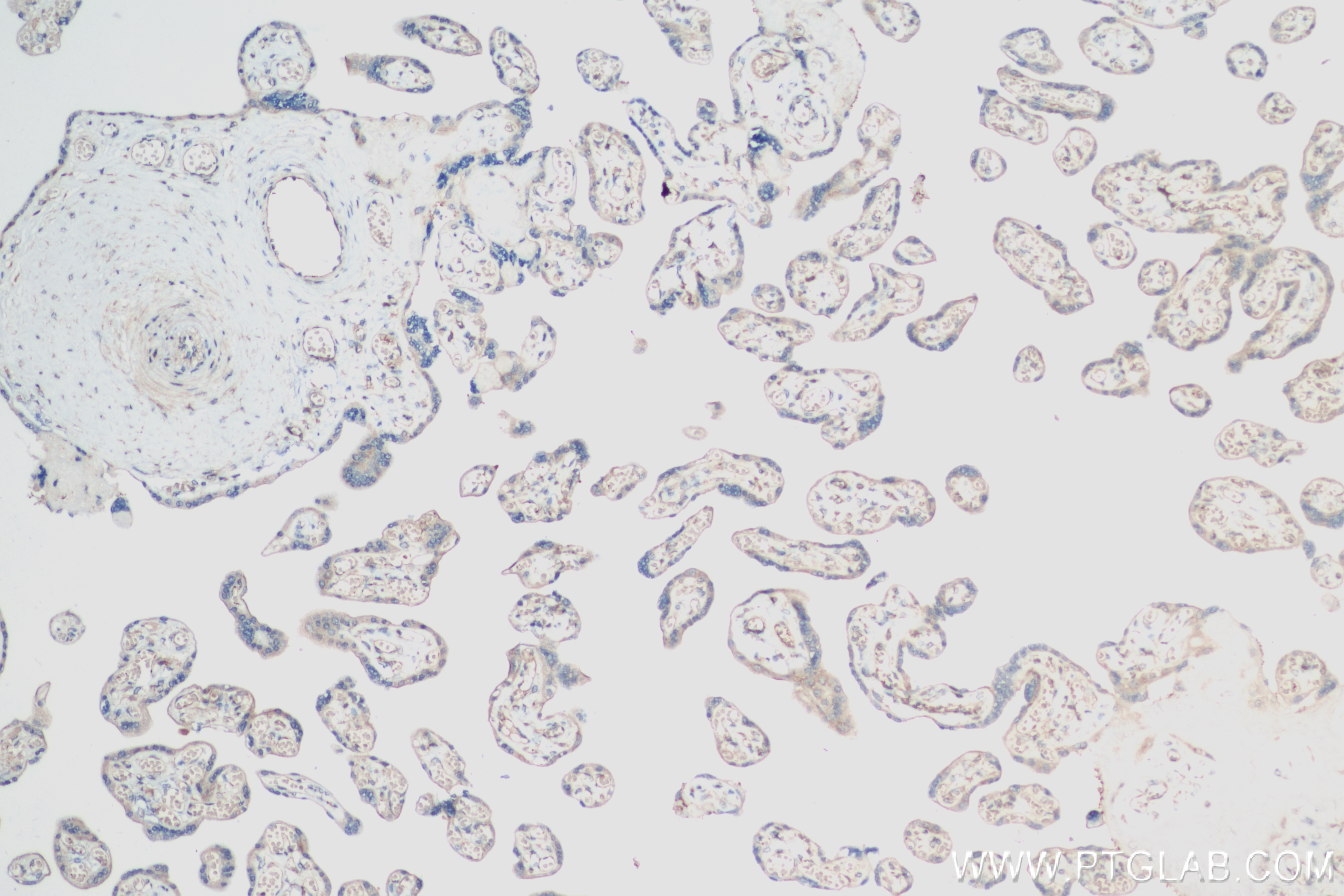 IHC staining of human placenta using 83655-3-RR