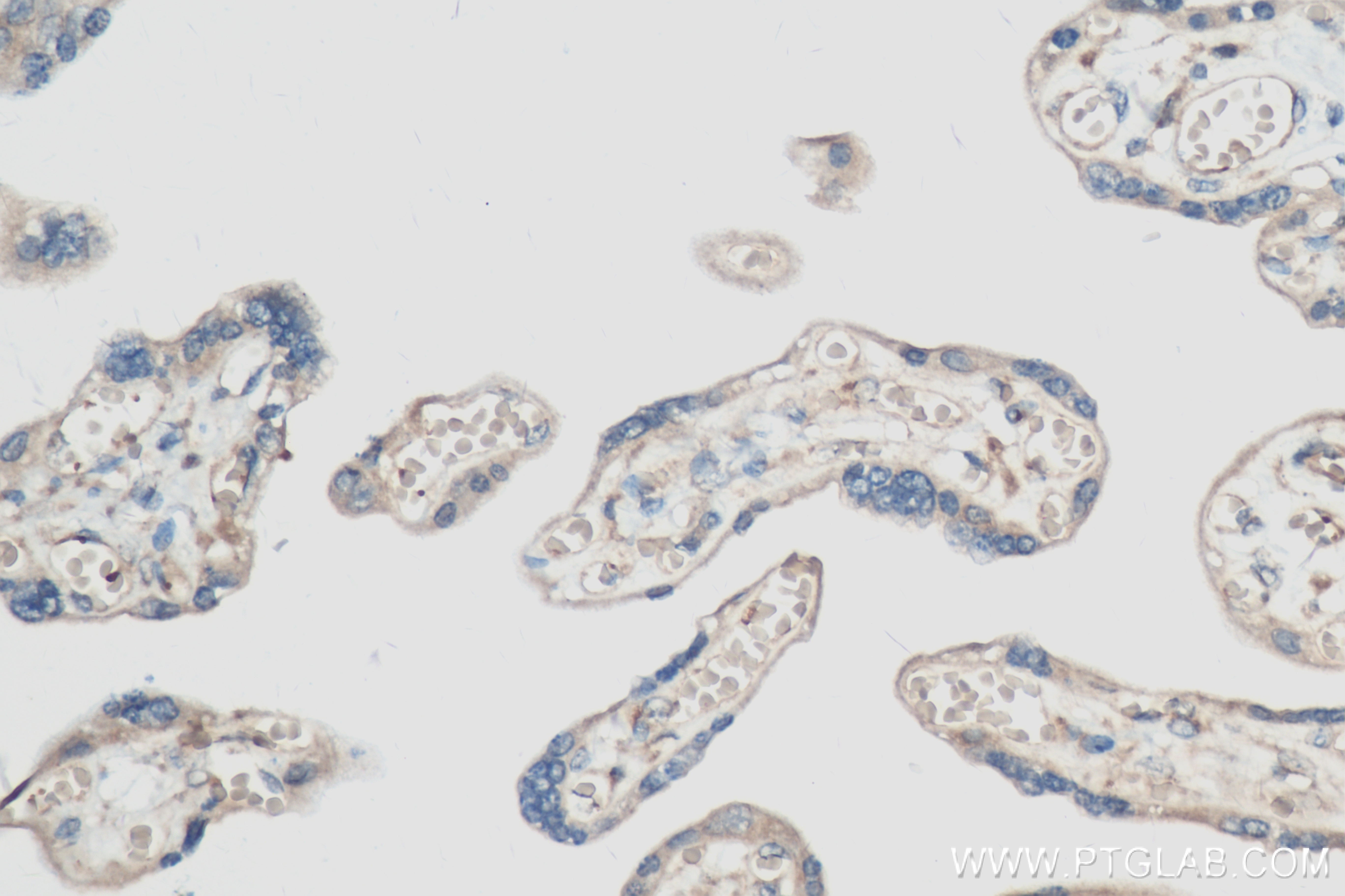 IHC staining of human placenta using 83655-3-RR