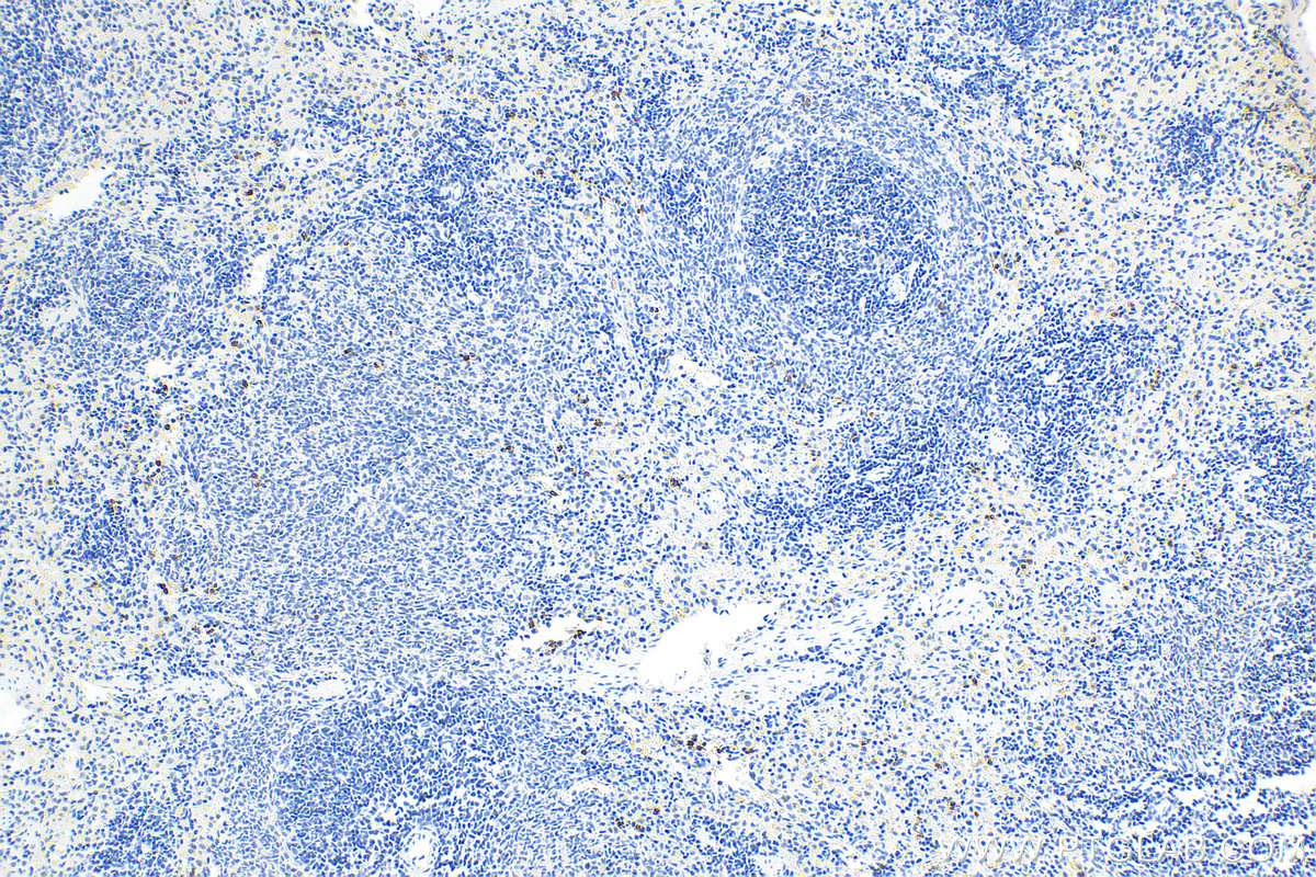 IHC staining of rat spleen using 31452-1-AP