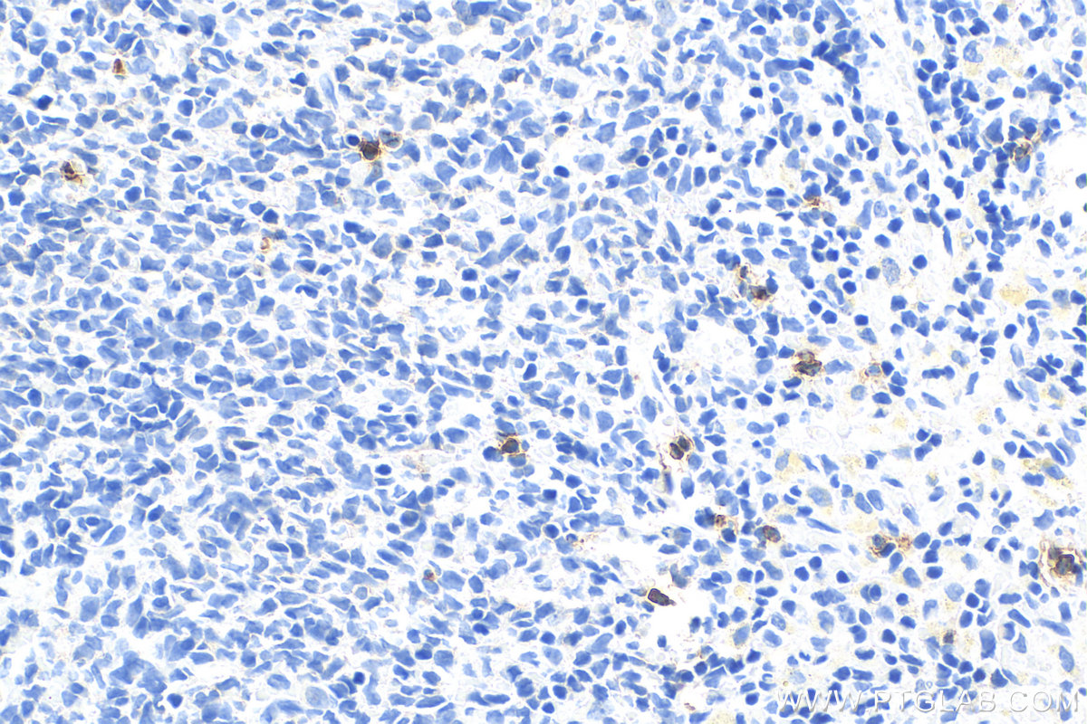 IHC staining of rat spleen using 31452-1-AP