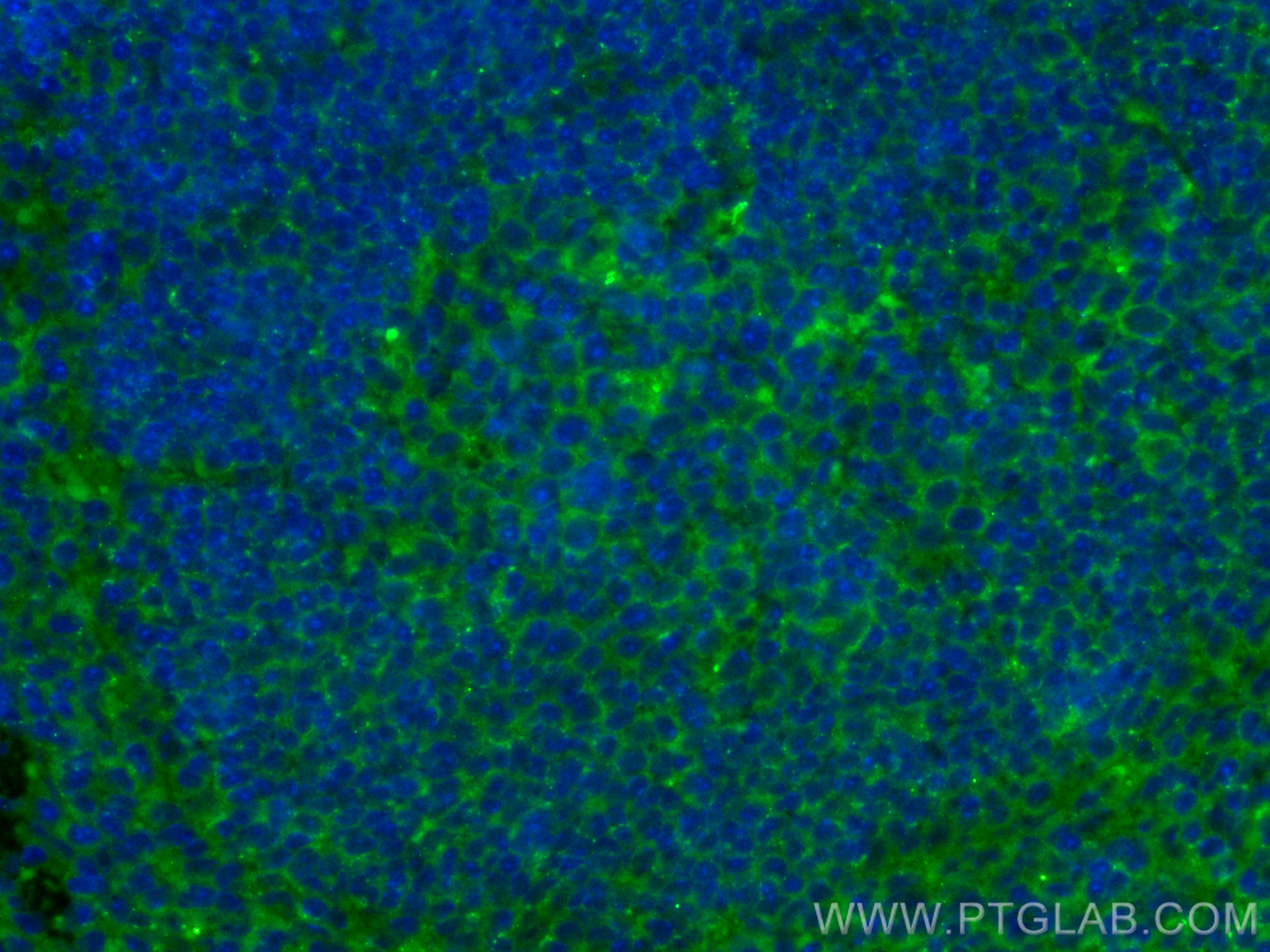 IF Staining of mouse spleen using CL488-10677