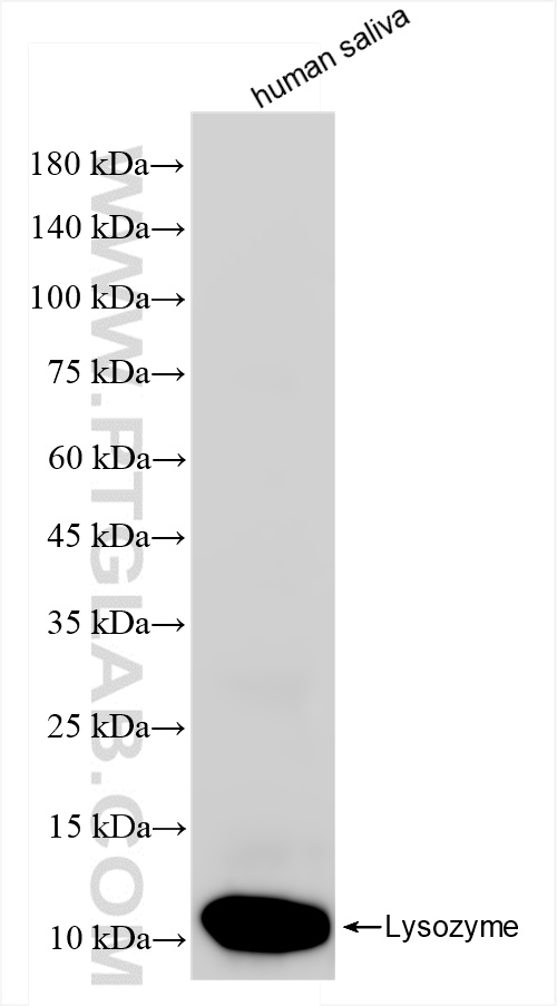 WB analysis of human saliva using 84140-1-RR (same clone as 84140-1-PBS)