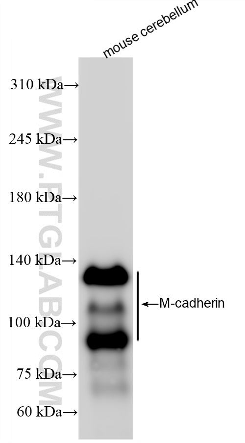 WB analysis of mouse cerebellum using 84440-5-RR