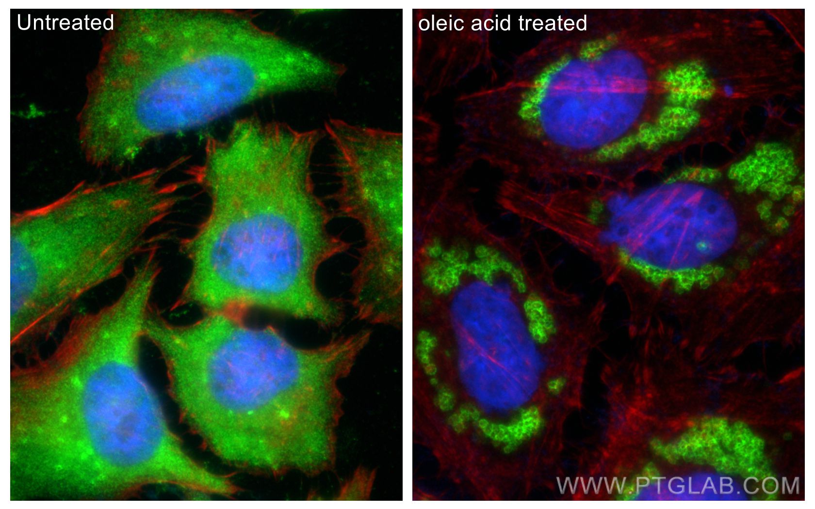 IF Staining of HeLa using 10694-1-AP