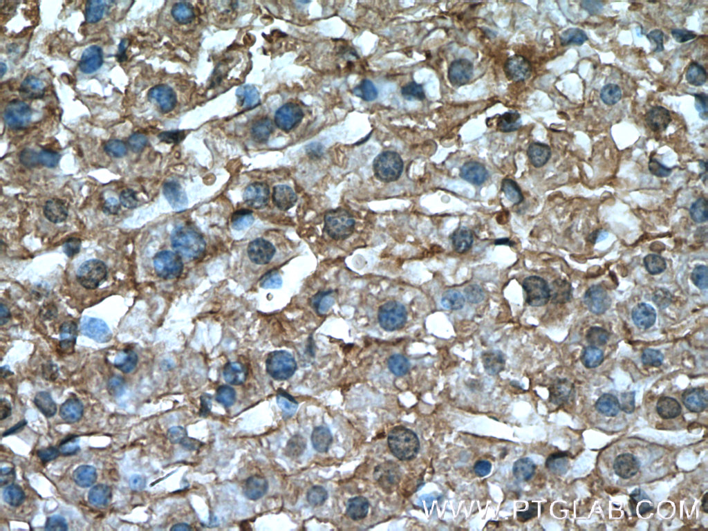 TIP47 Polyclonal antibody