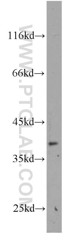 WB analysis of mouse brain using 10971-1-AP