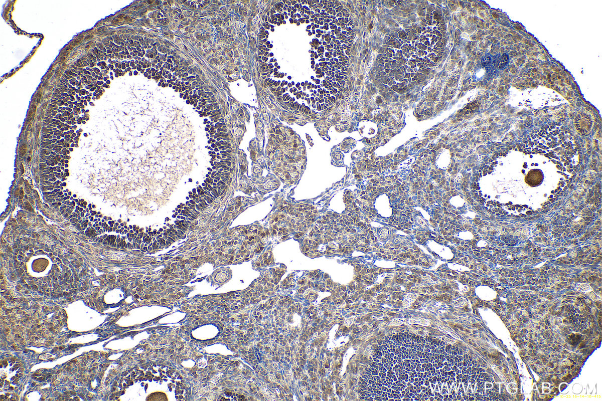 IHC staining of mouse ovary using 10337-1-AP