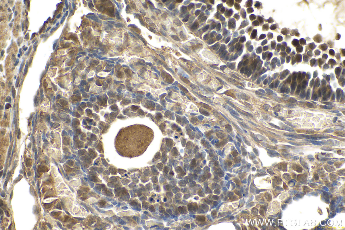 IHC staining of mouse ovary using 10337-1-AP