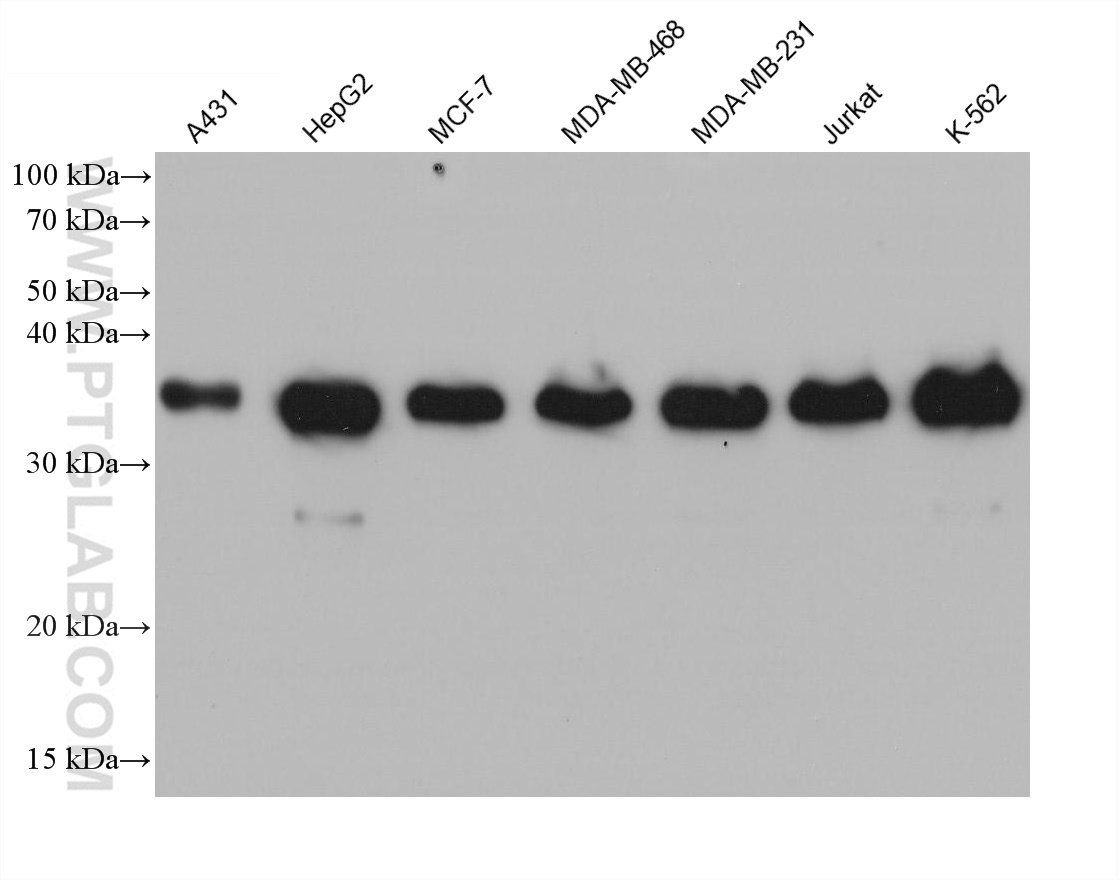 WB analysis using 68336-1-Ig