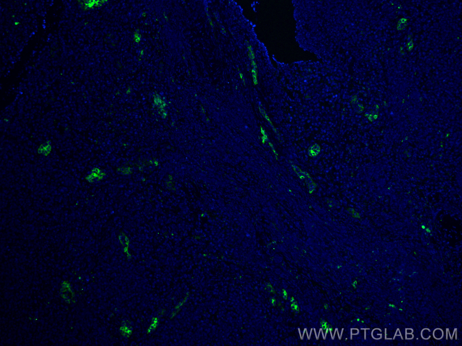 IF Staining of human tonsillitis using 66594-1-Ig