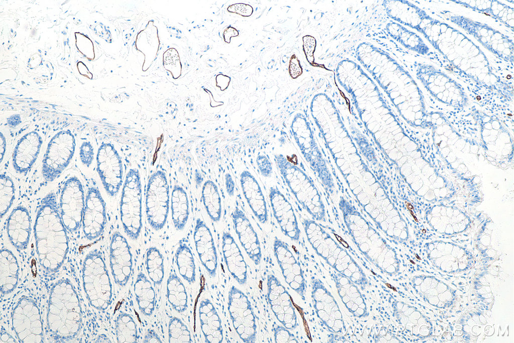 IHC staining of human colon using 66594-1-Ig (same clone as 66594-1-PBS)