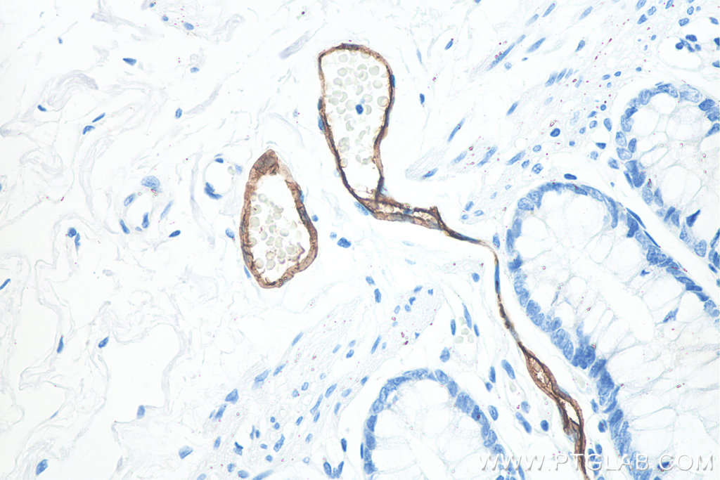 IHC staining of human colon using 66594-1-Ig (same clone as 66594-1-PBS)