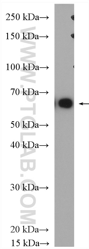 WB analysis of A375 using 15295-1-AP