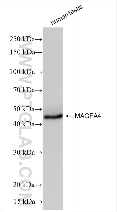 MAGEA4