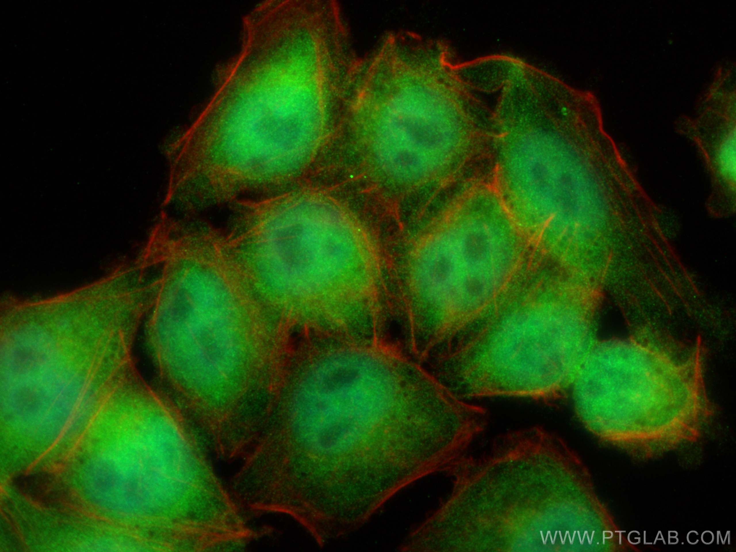 IF Staining of A375 using 14602-1-AP