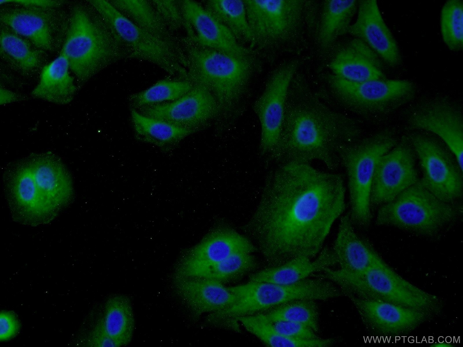 IF Staining of A549 using 17494-1-AP